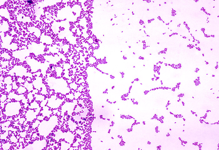 Streptococcus mutans converts sugar into acid, causing enamel erosion.