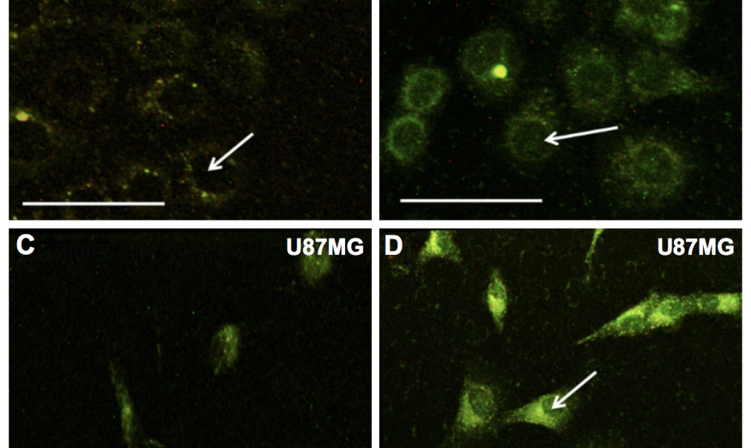 Three-photon microscopy images of (A and B) breast cancer cells and (C and D) glioblastoma cells.