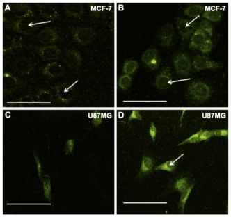 Three-photon microscopy images of (A and B) breast cancer cells and (C and D) glioblastoma cells.
