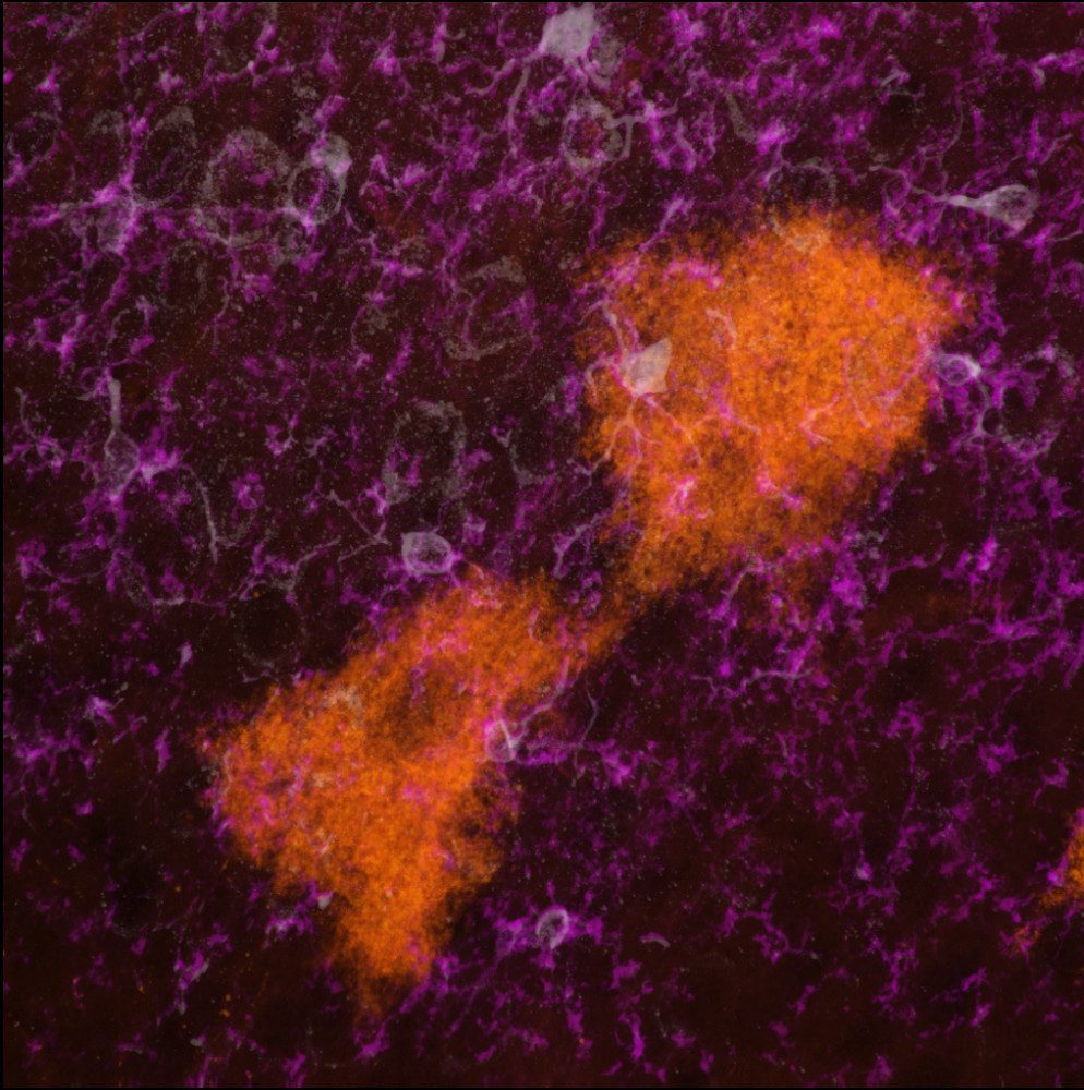 Microscopy image of extracellular vesicles being taken up by microglia