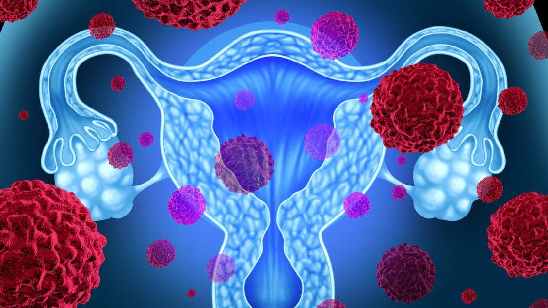 illustration of human uterus and cancer cells