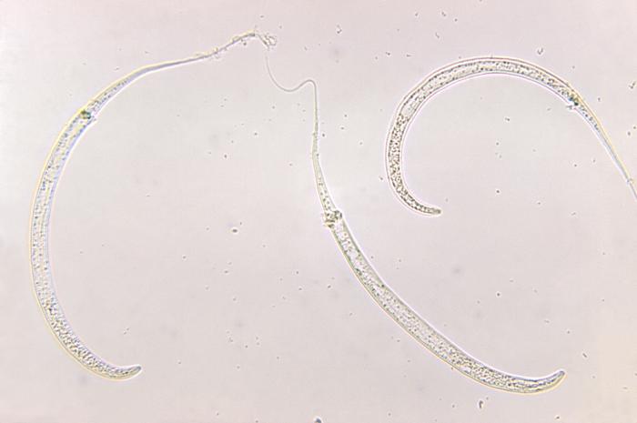 A microscopic image of three, long, pointed worms.