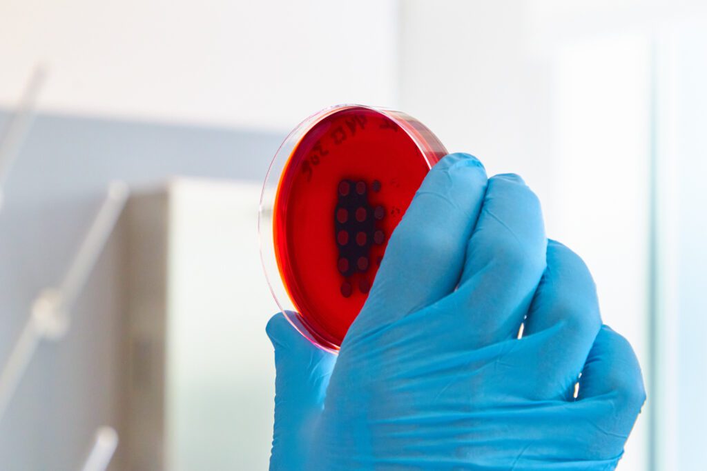 A close up of a blue gloved hand holding up a red Agar tray with a black cellular growth on it.