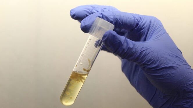 This vial holds Aspergillus parasiticus, a species of fungus commonly found in foodstuffs, known for producing toxic carcinogenic metabolites called aflatoxins. Sachin Rustgi, a Clemson molecular breeder, is leading a group of scientists who are studying to determine a more reliable way to fight aflatoxin contamination.