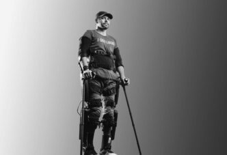 Adam Gortlisky standing with arm, leg and torso braces wearing a T-shirt that reads I GOT LEGS.