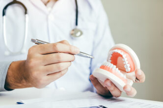 A person in a white lab coat holding a model of a mouth full of teeth.