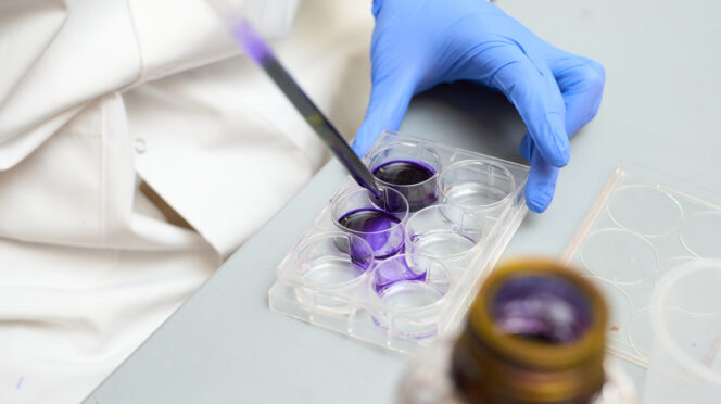 A pipette containing purple liquid is placed into a tray, which is held by a hand in a blue glove.