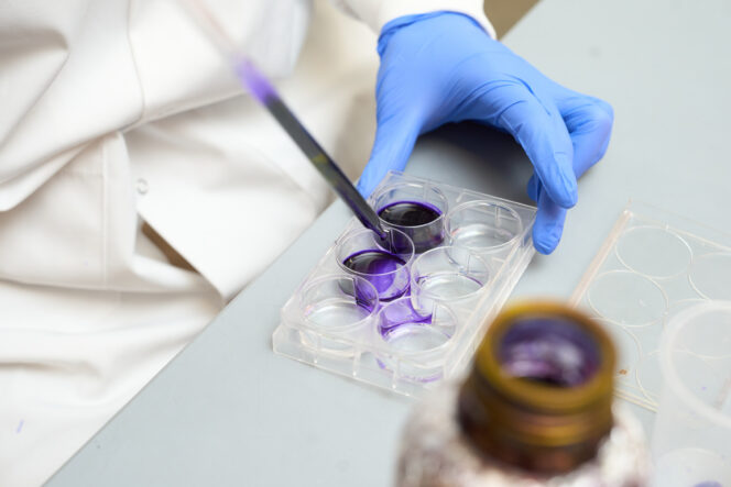 A pipette containing purple liquid is placed into a tray, which is held by a hand in a blue glove.