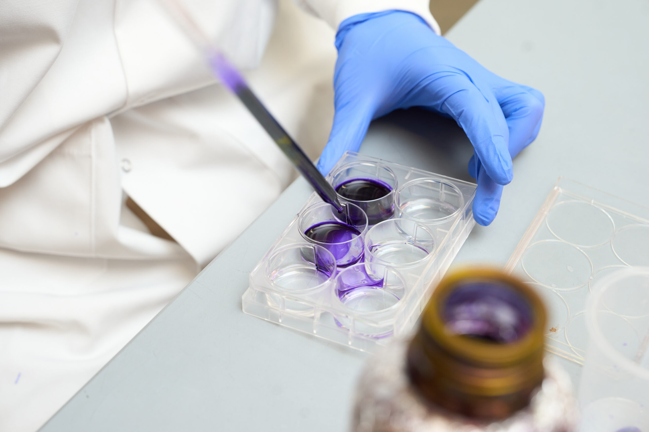 A pipette containing purple liquid is placed into a tray, which is held by a hand in a blue glove.